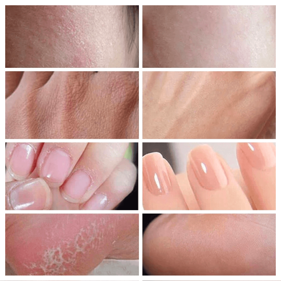 Crema Hidratante para Piel