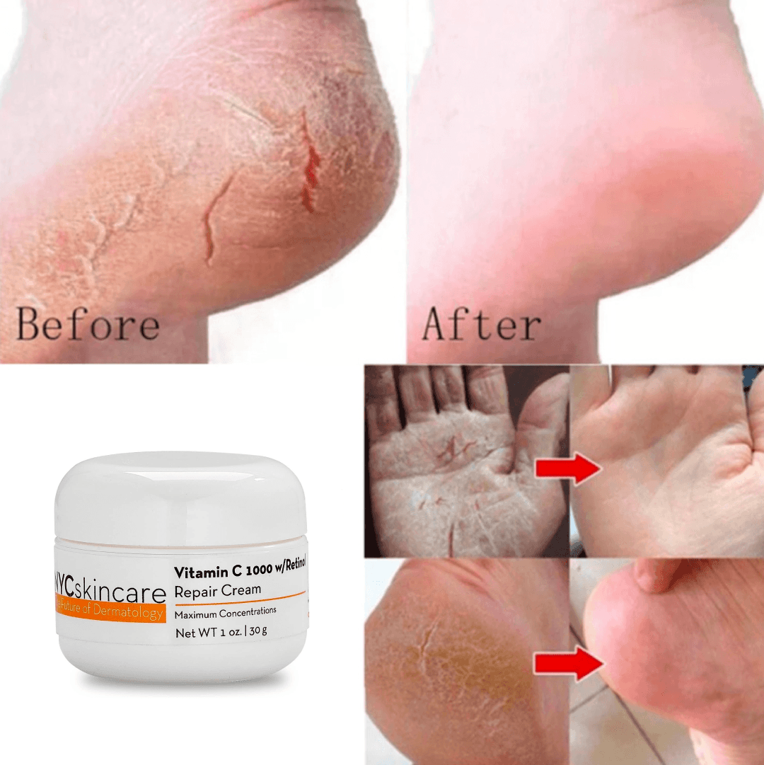 Crema Hidratante para Piel