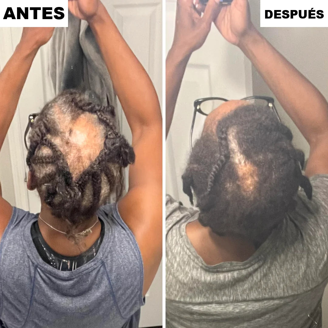 Resultado real tras tres semanas de uso