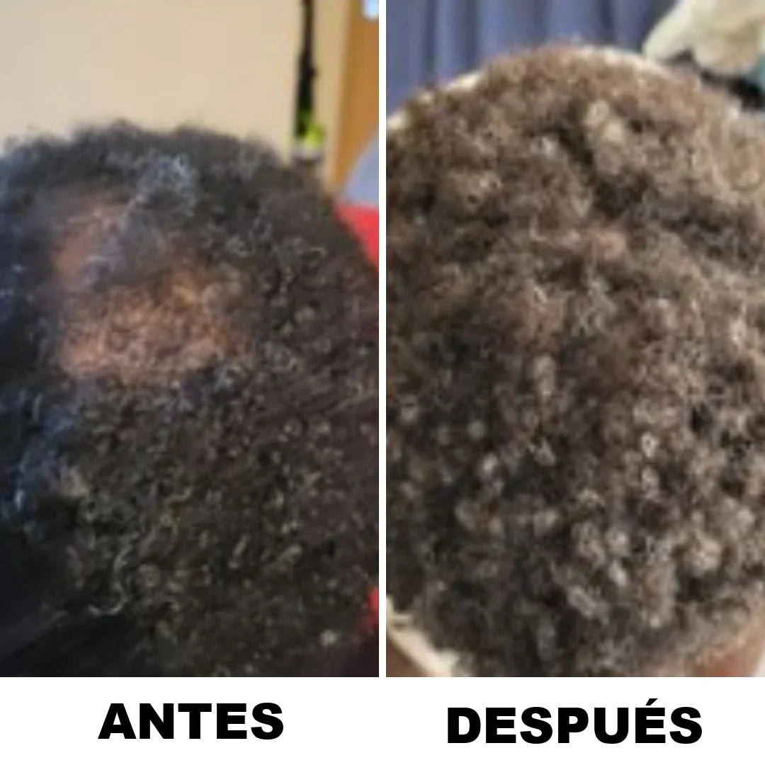 Resultado real de una clienta tras un mes de uso